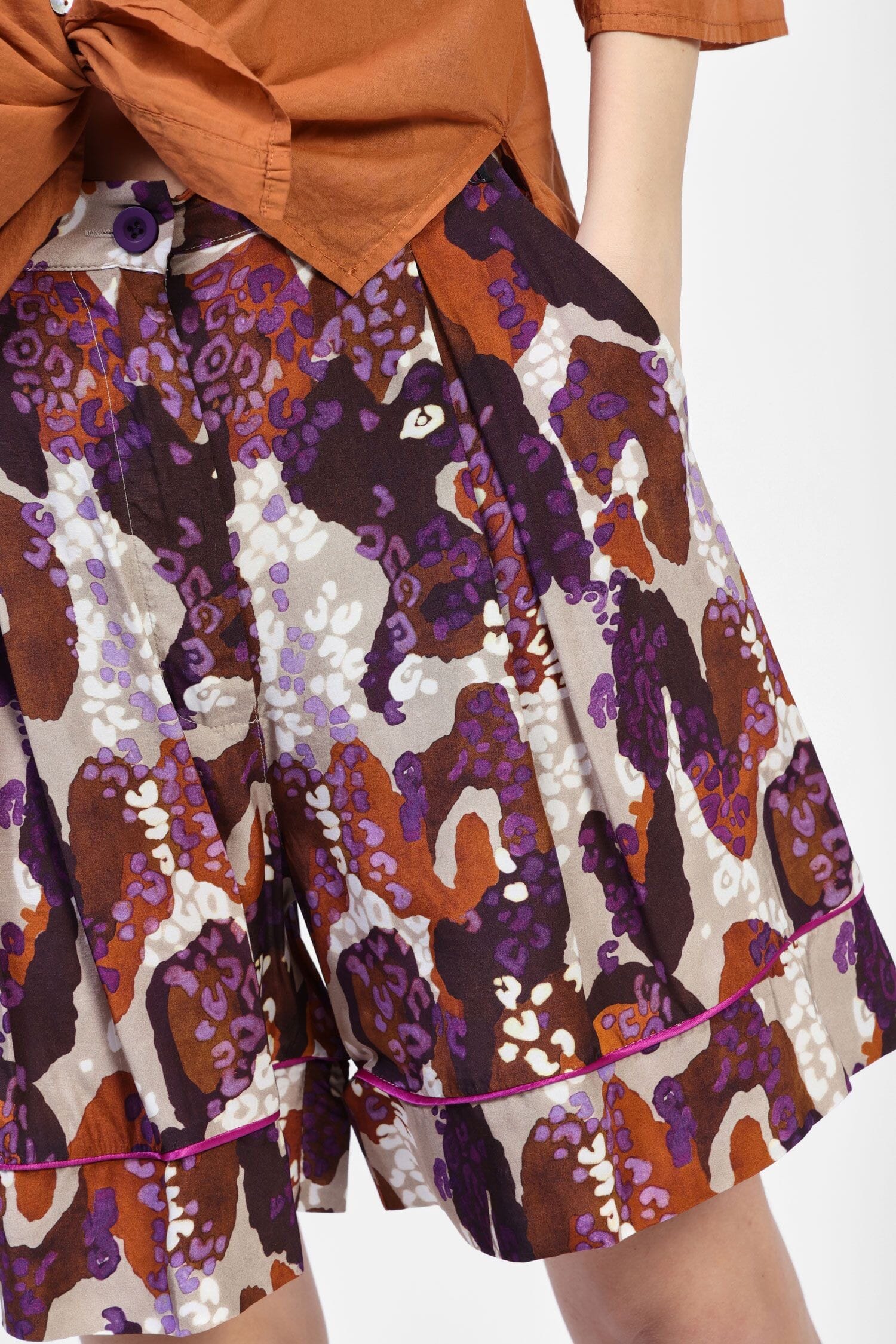 Bermuda Shorts With Print And Dixie Buttons